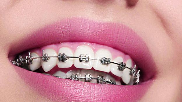 بهترین سرویس ارتودنسی دندان را در کلینیک دندانپزشکی دکتر سریتا تجربه کنید