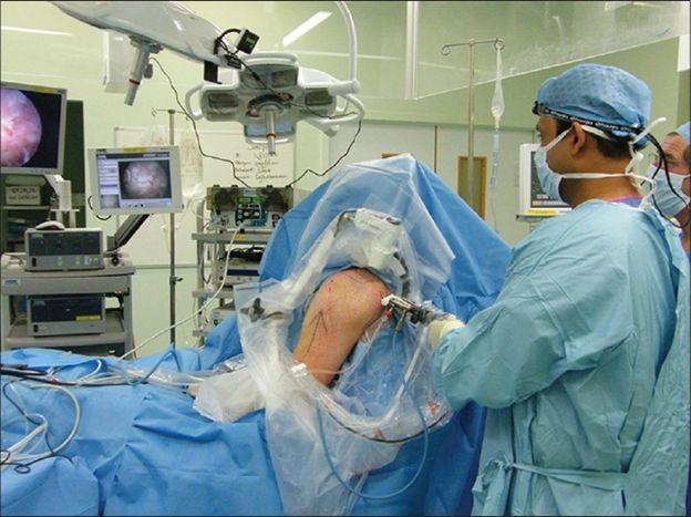 درمان و جراحی بیماری های شانه و آرنج در کلینیک دکترعلیرضا فرهمندی