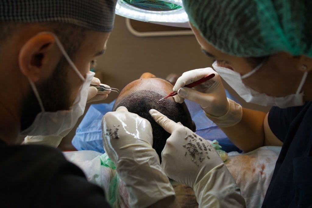 انواع روش های کاشت مو در بهترین کلینیک های کاشت موی مشهد