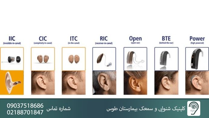 نکات مهم برای خرید سمعک