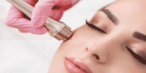 دستگاه میکرودرم