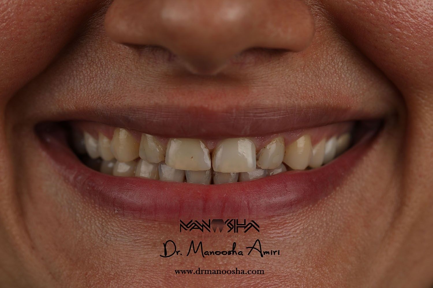 دندانپزشک زیبایی در رشت،دکتر مانوشا امیری