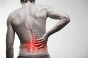 علائم دیسک کمر فیزیوتراپی فانتوم زنجان