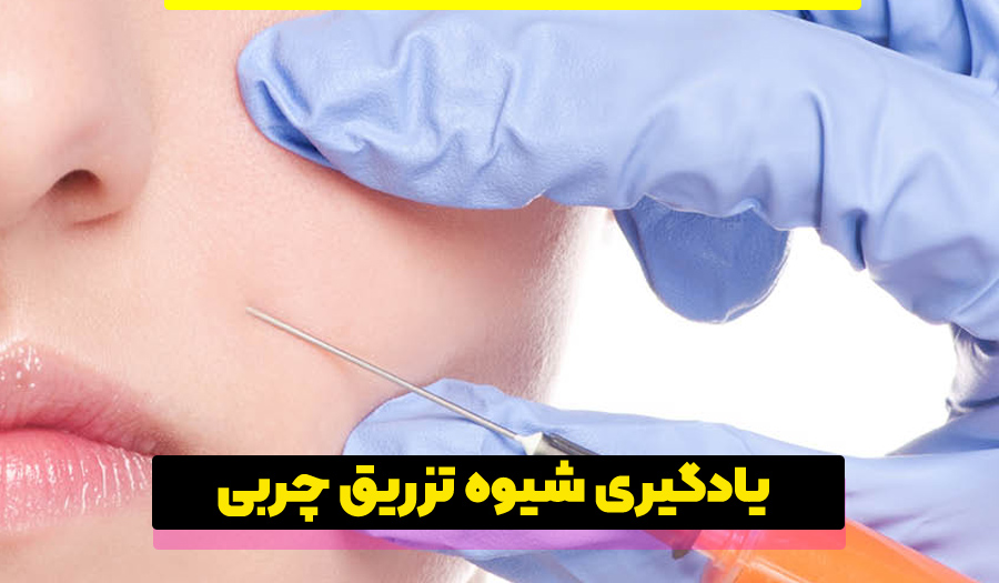 چند روز بعد از تزریق چربی صورت به حالت طبیعی برمیگردد؟