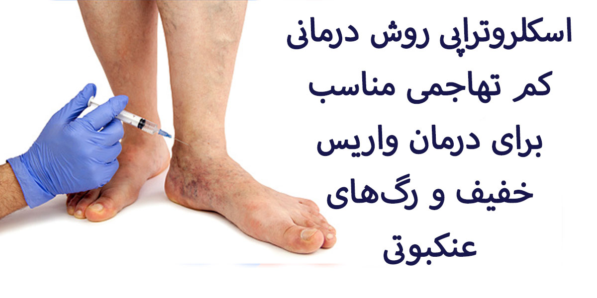 اسکلروتراپی چیست