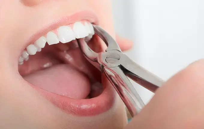 دندانپزشکی اقساطی
