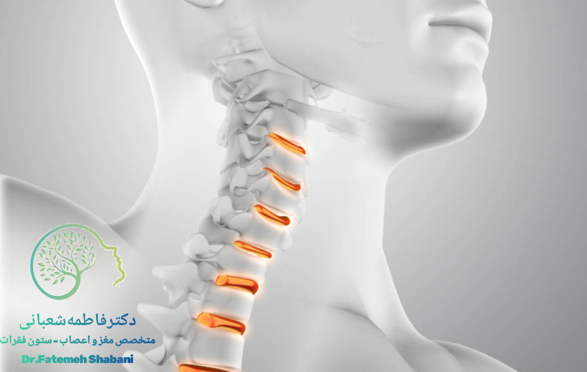 دیسک گردن باعث چه دردهایی می‌شود