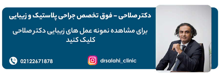 لیفت صورت : بهترین روش برای رفع افتادگی پوست