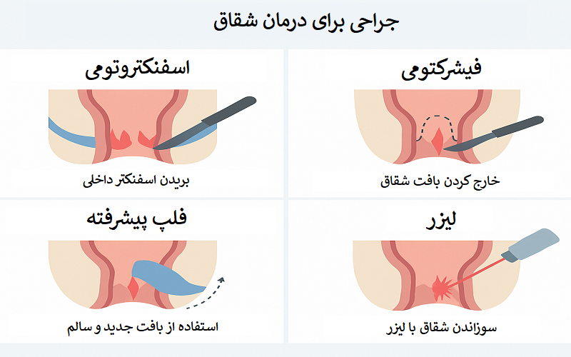 عمل شقاق