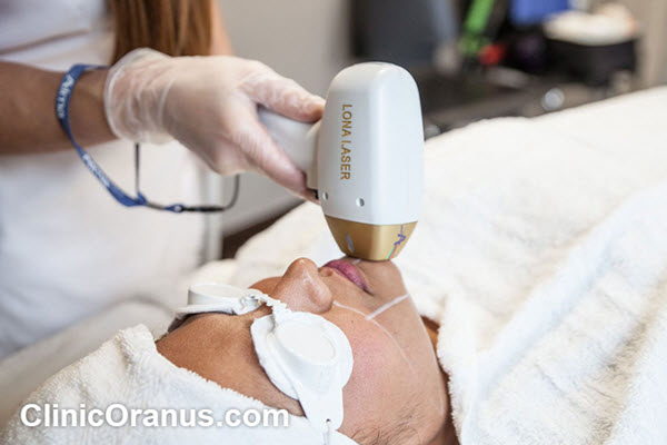 برخی از ویژگی های بهترین کلینیک لیزر موهای زائد | کلینیک اورانوس