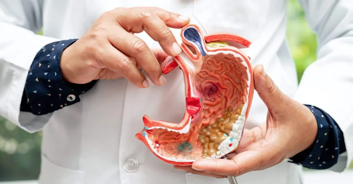 قبل از عمل اسلیو چه باید بدانید؟ از رژیم پیشعمل تا آزمایشها