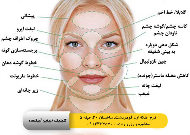 لیفت صورت کرج