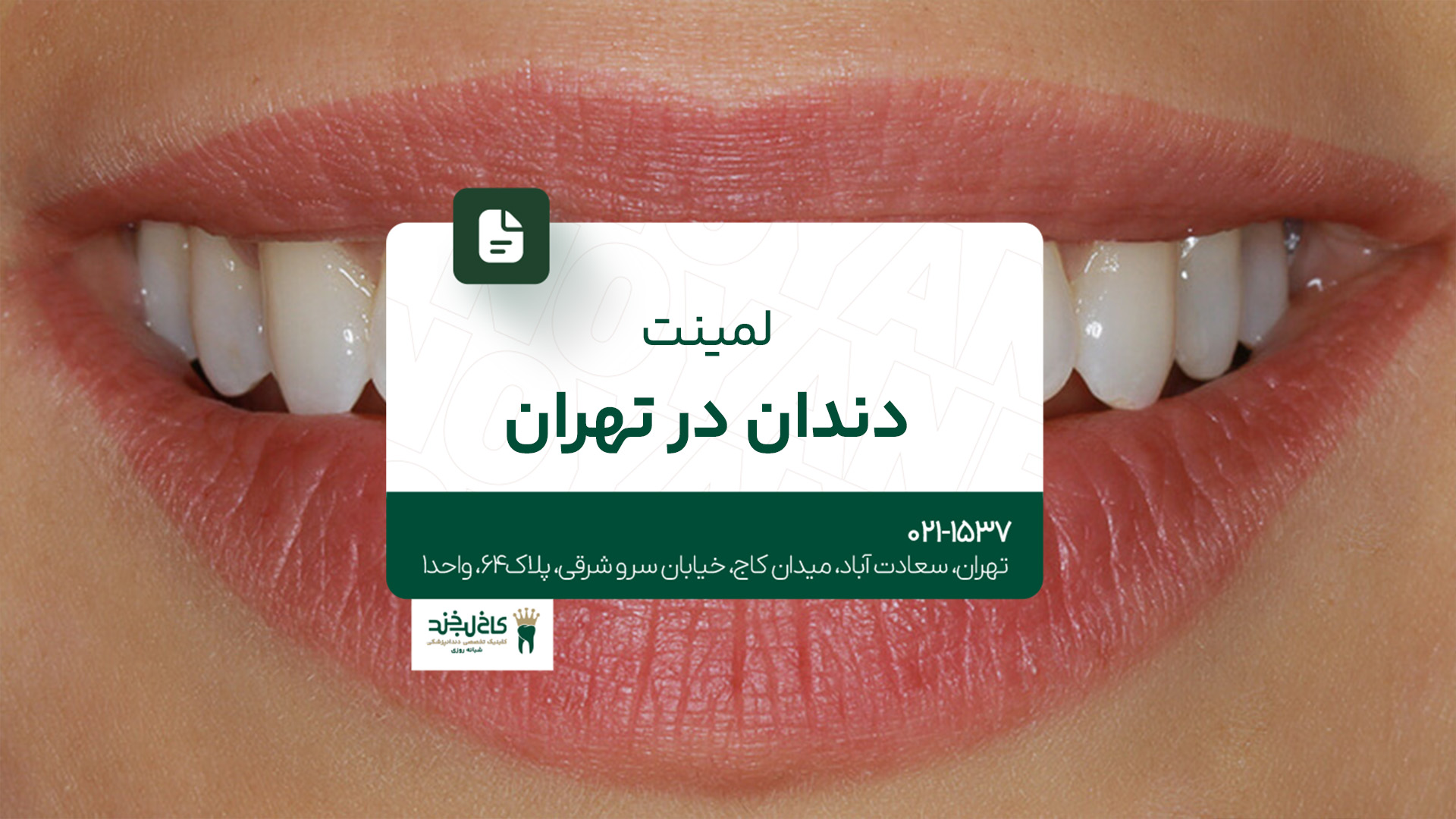 لمینت دندان در تهران