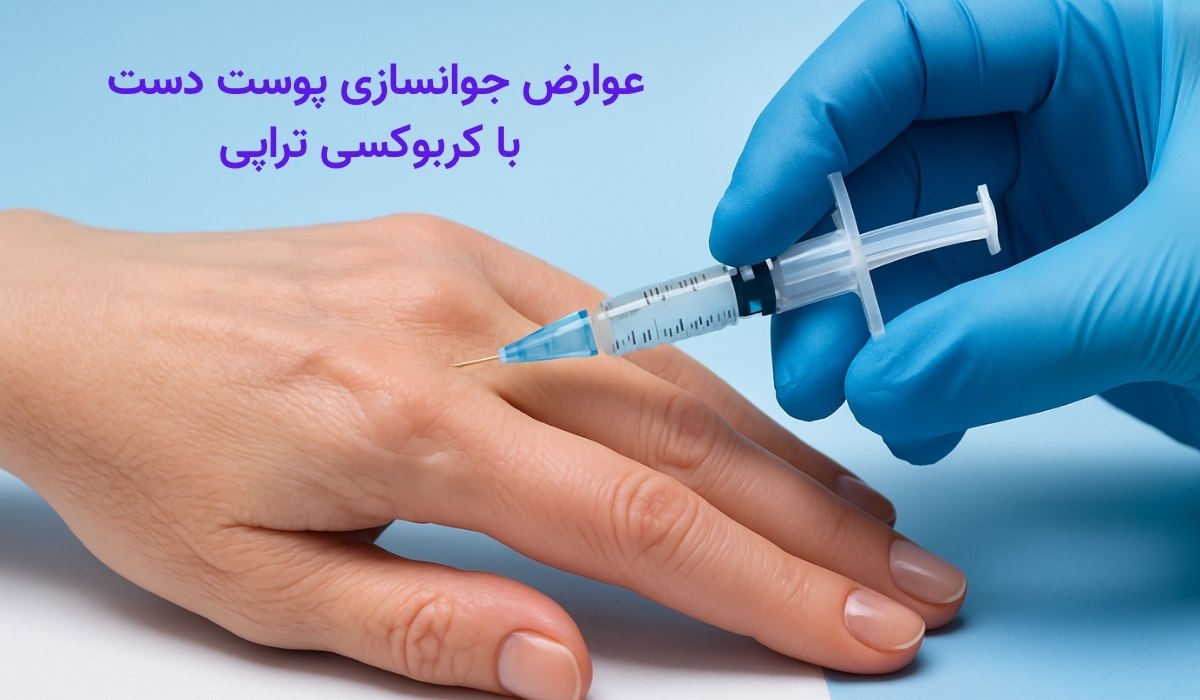 جوانسازی پوست دست با کربوکسی تراپی