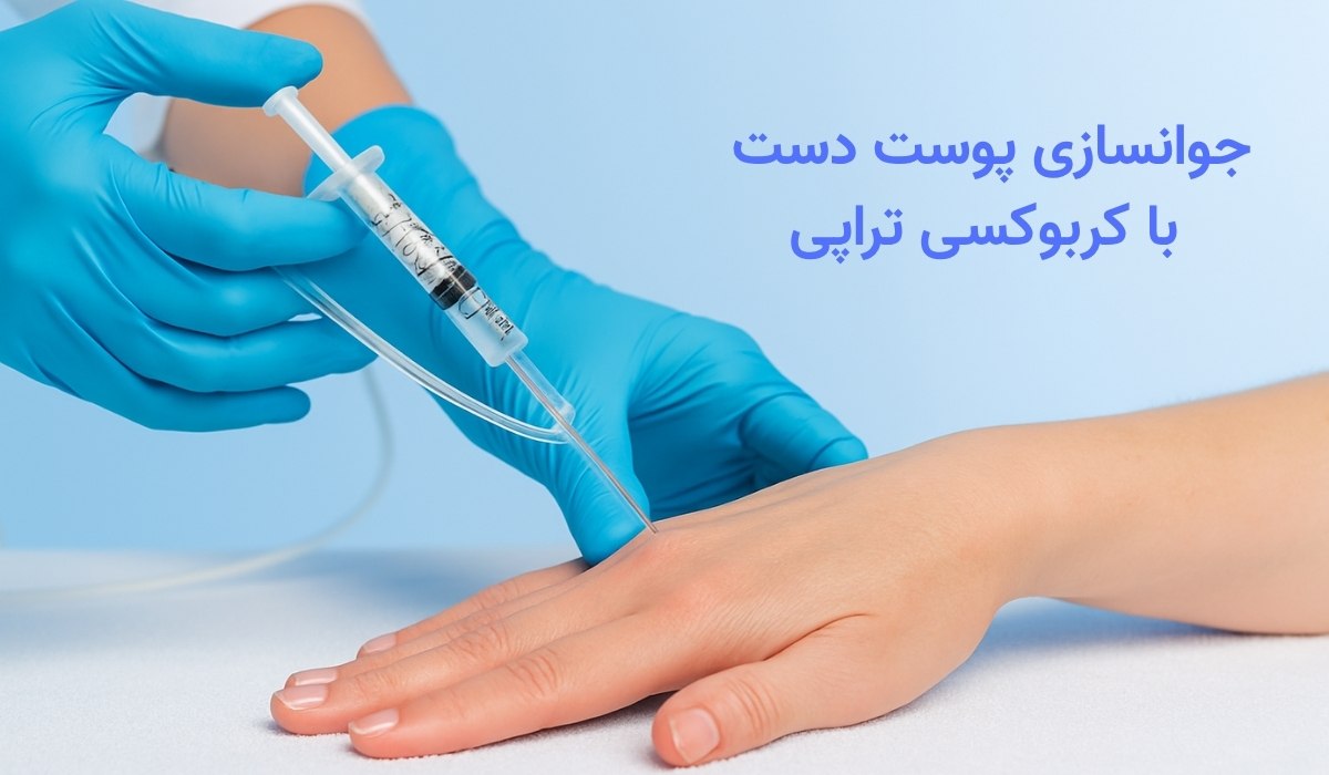 جوانسازی پوست دست با کربوکسی تراپی