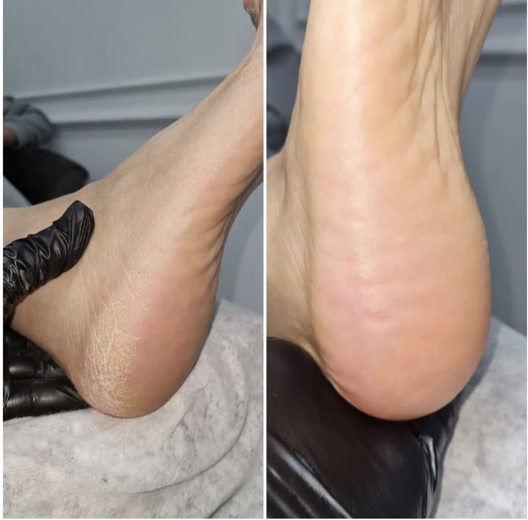 پدیکور کفسابی مردانه تهرانبکس