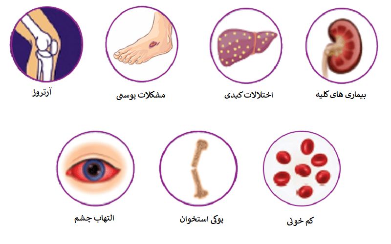 آیا التهاب روده خطرناک است