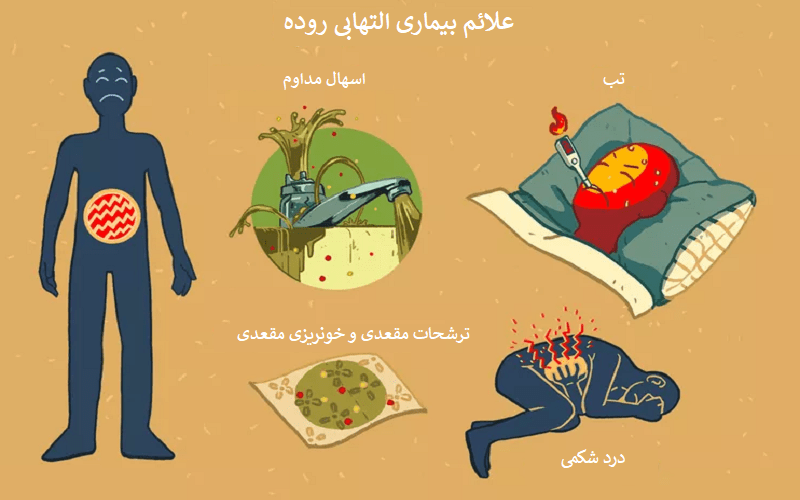 علائم بیماری التهابی روده