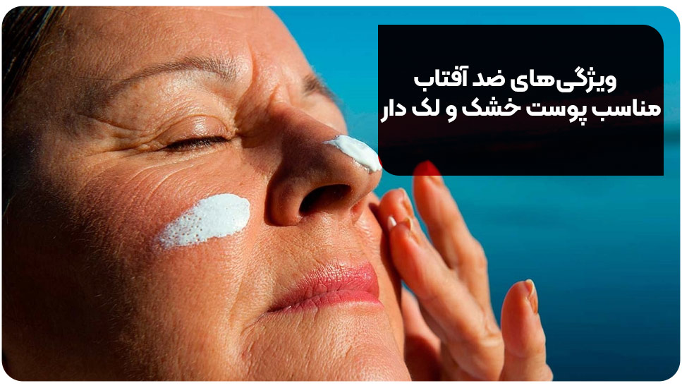 ویژگی‌های ضد آفتاب مناسب پوست خشک و لک‌دار