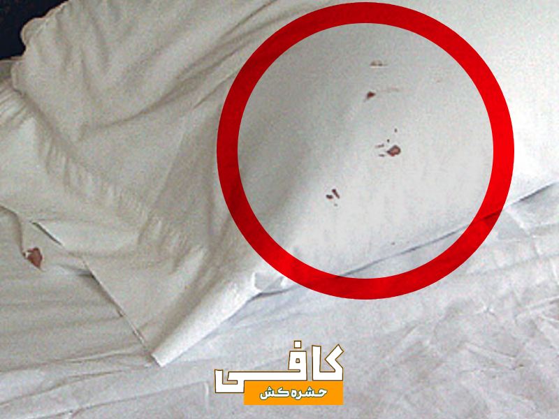 اینها علائم ساس در منزل هستند (0 تا 100 پیدا کردن و از بین بردن حشره ساس)