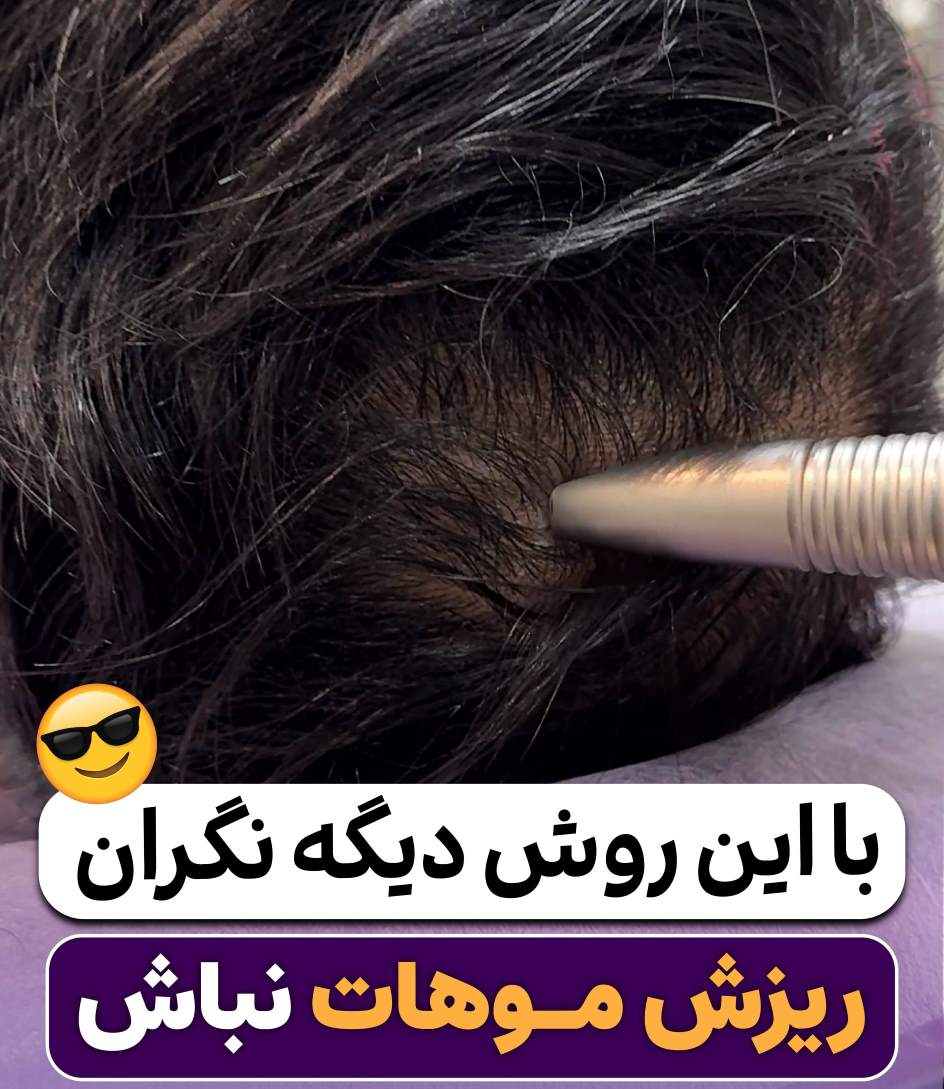 فوتونا مو سر در مشهد