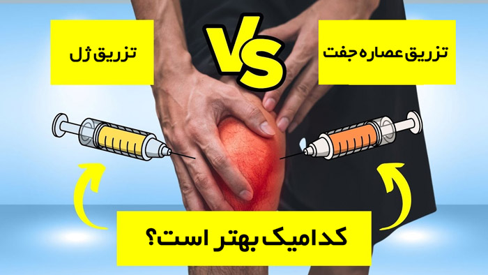 درمانی نوین برای آرتروز زانو: آیا تزریق عصاره جفت جایگزین جراحی خواهد شد؟