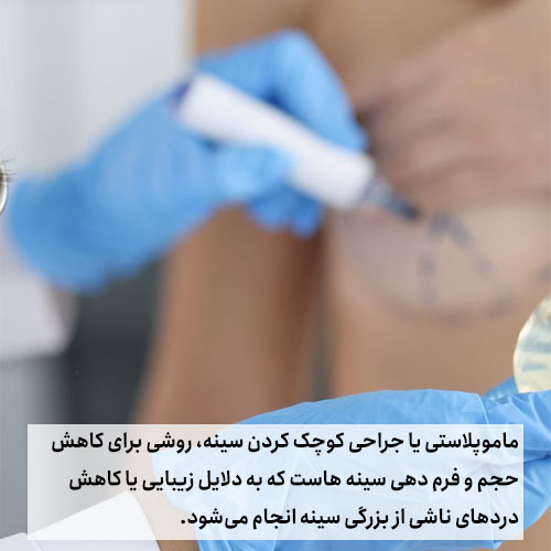 سوالات متداول پیش از انجام عمل ماموپلاستی