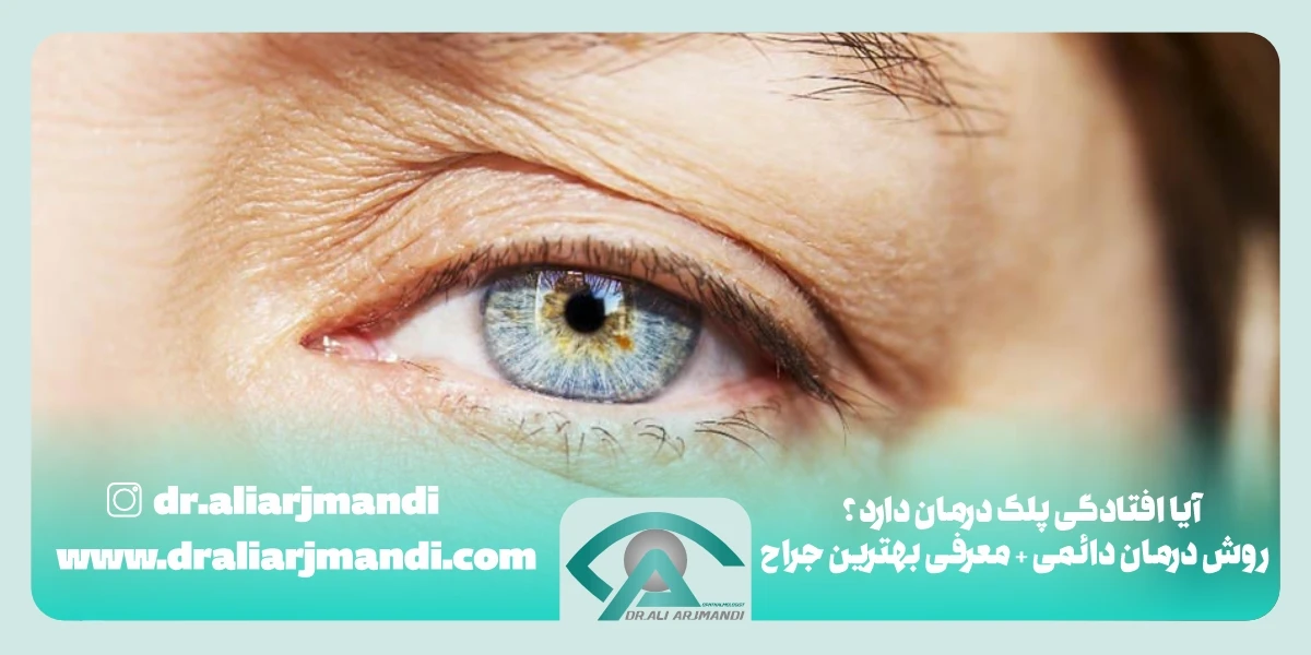 آیا افتادگی پلک درمان دارد؟