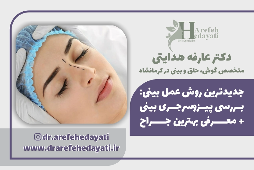 جدیدترین روش عمل بینی در سال 1404 | پیزوسرجری با دکتر عارفه هدایتی