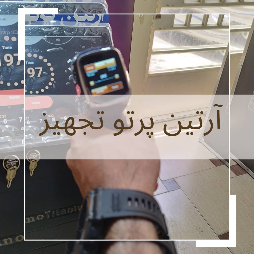 🚀 مدلهای KM و Alma با پشتیبانی VIP – فرصت محدود!