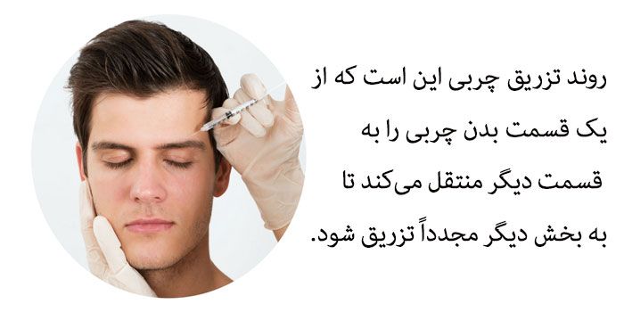 تزریق چربی بدون درد