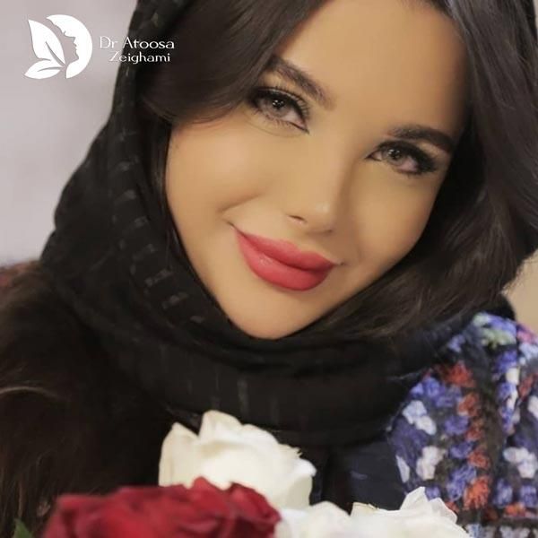 جراحی بینی گوشتی دکتر ضیغمی