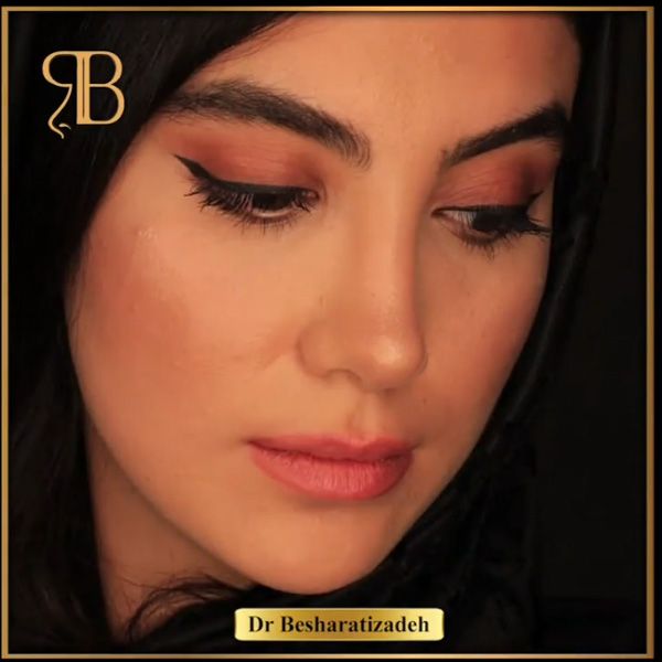 عمل بینی 