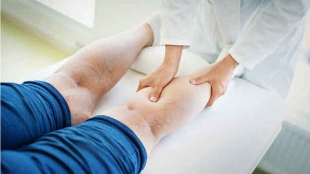 لیزر واریس پا؛ عوارض و مراقبت های بعد ازآن