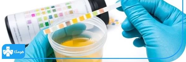 آزمایش ادرار در منزل