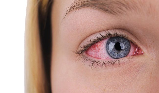 رعایت نکردن توصیه های لازم قبل از جراحی لیزر چشم می تواند مشکلات زیادی را ایجاد کند.