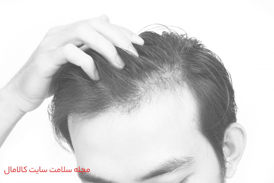 رویش مجدد مو وشامپو صبغ