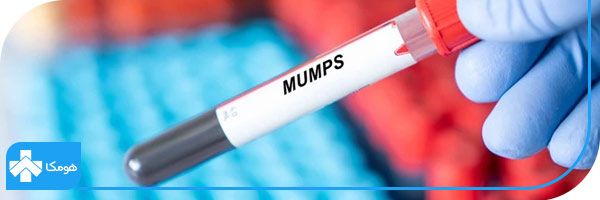 ویروس mumps