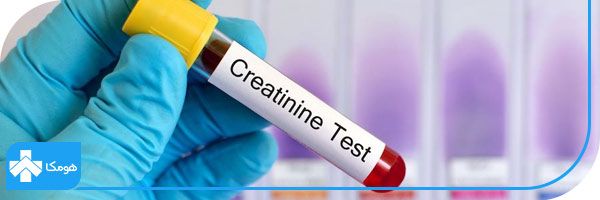 مشکلات کلیه با چه آزمایشاتی تشخیص داده میشود؟ 8 creat در آزمایش