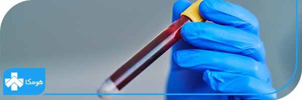 مشکلات کلیه با چه آزمایشاتی تشخیص داده میشود؟ 9 آزمایش کراتینین