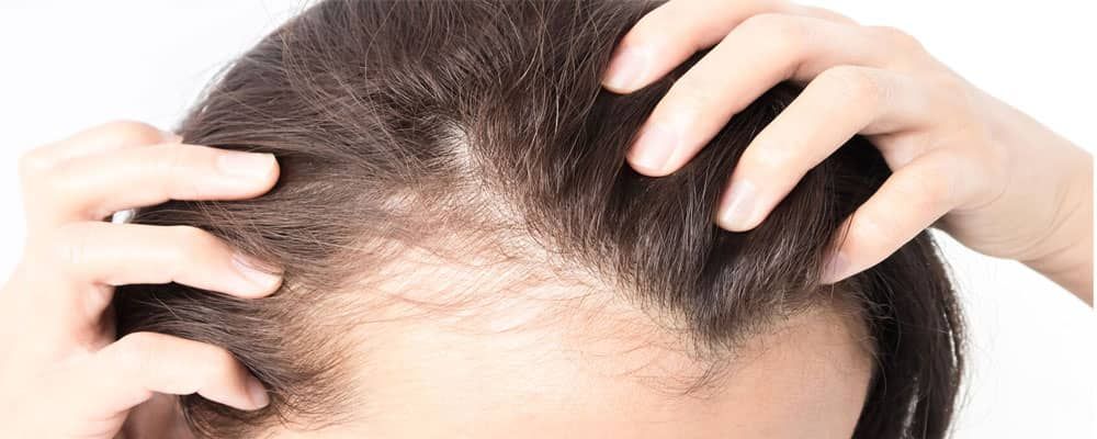 رعایت دستورات بعد از کاشت مو به بهتر شدن عمل کاشت مو شما کمک می کند