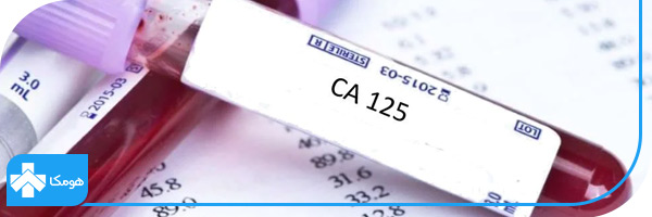 آزمایش ca125 چیست