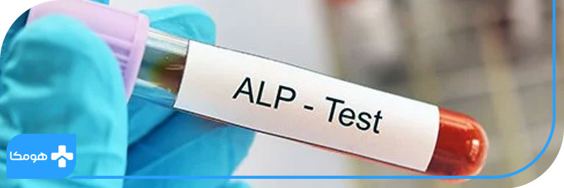 alp در آزمایش خون