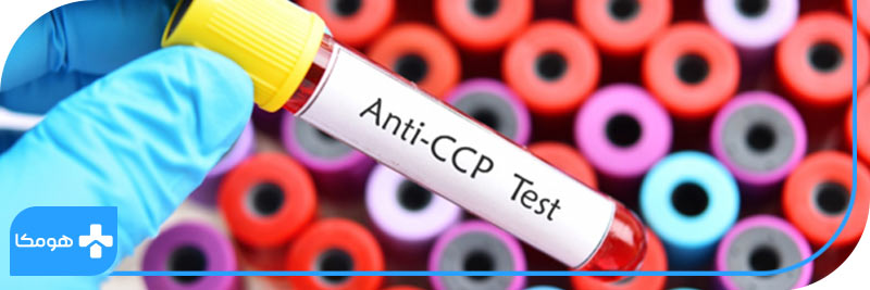 anticcp در آزمایش خون