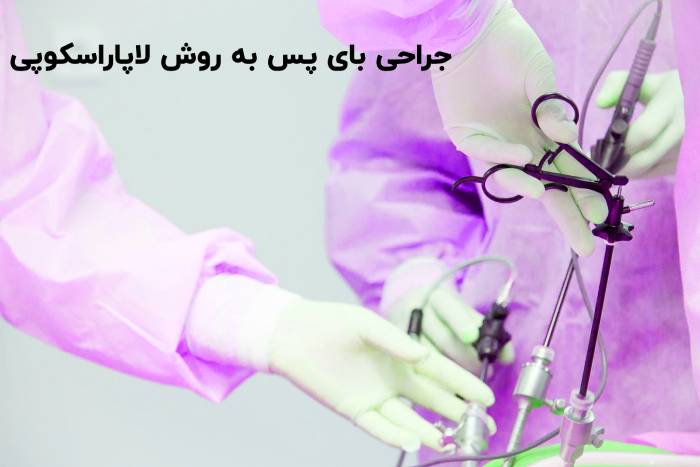 جراحی بای پس با لاپاراسکوپی