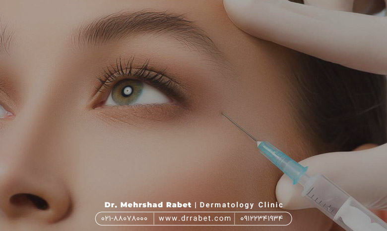 تزریق بوتاکس