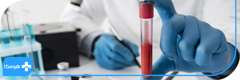 mchc در آزمایش خون