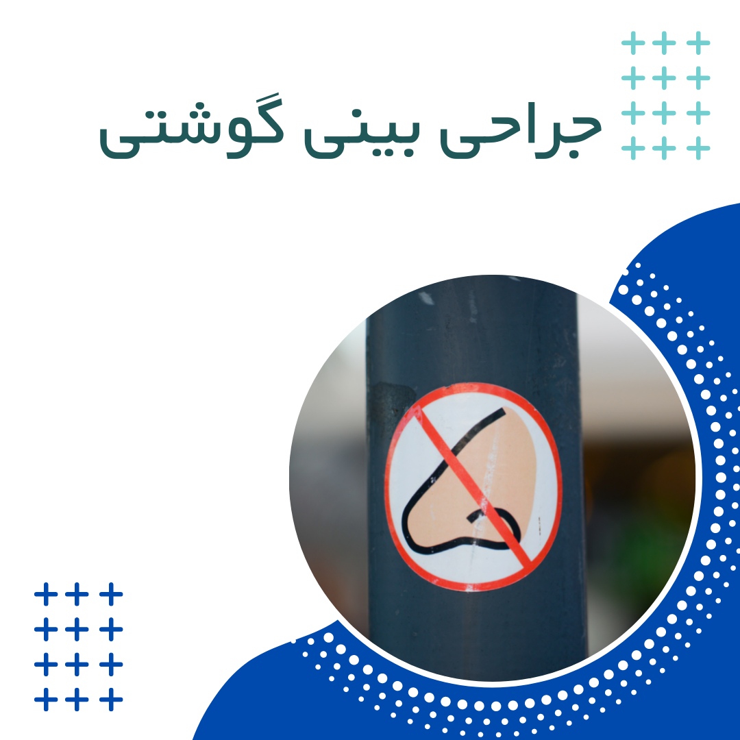 جراحی بینی استخوانی در کرج