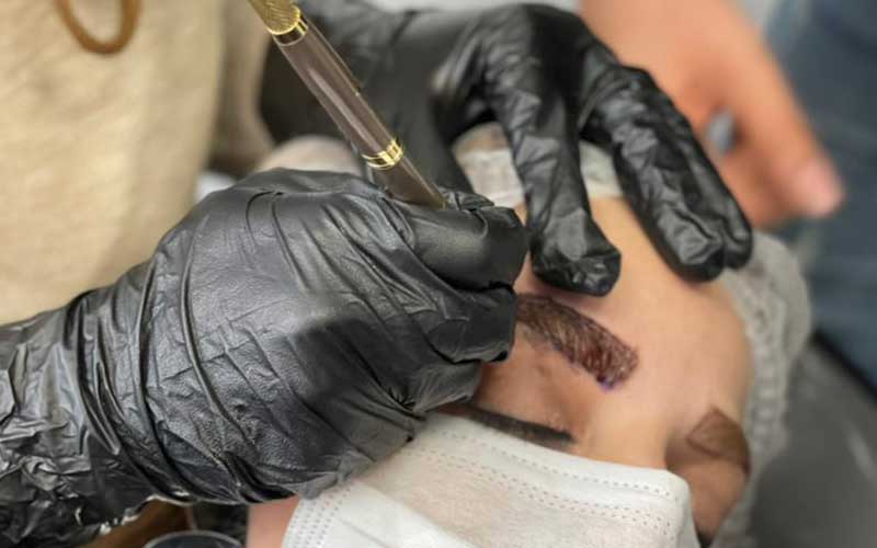 دوره فیبروز دترلند