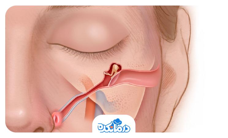 Eustachian tube keeps the air pressure equal on either side of the eardrum.